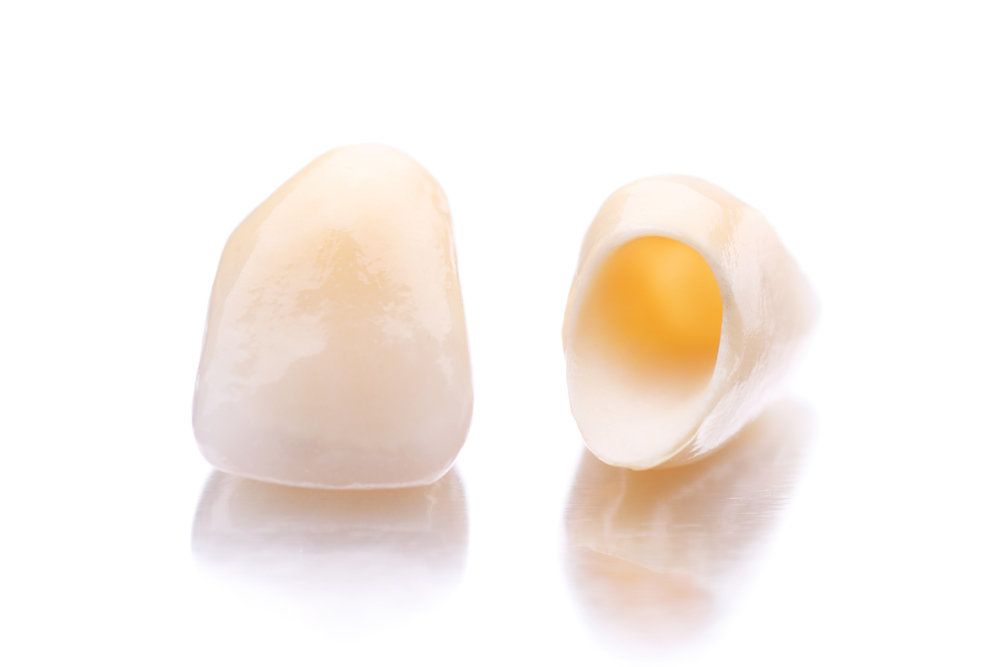All-ceramic restorations.